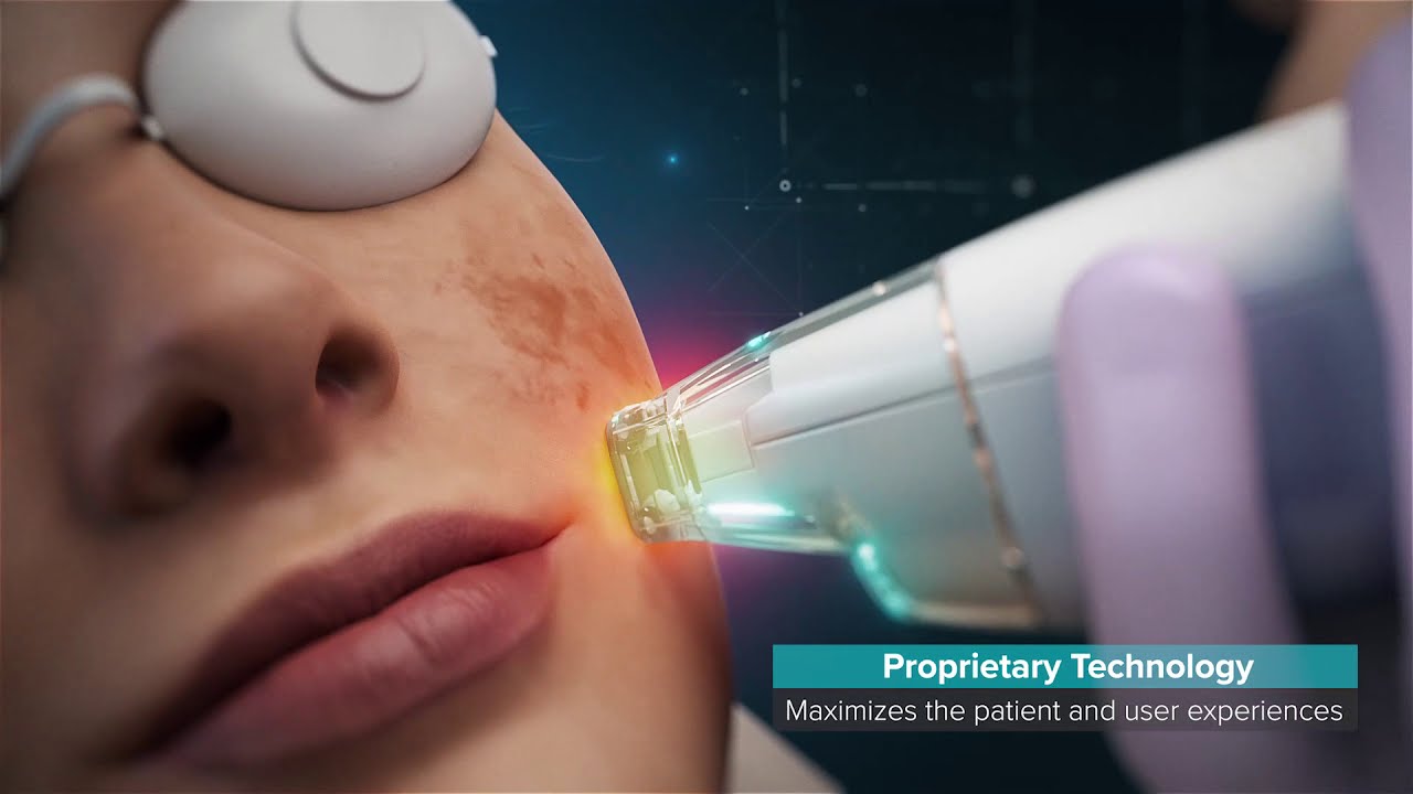 A Smart Laser for All Patients - Aesthetic Medical Practitioner