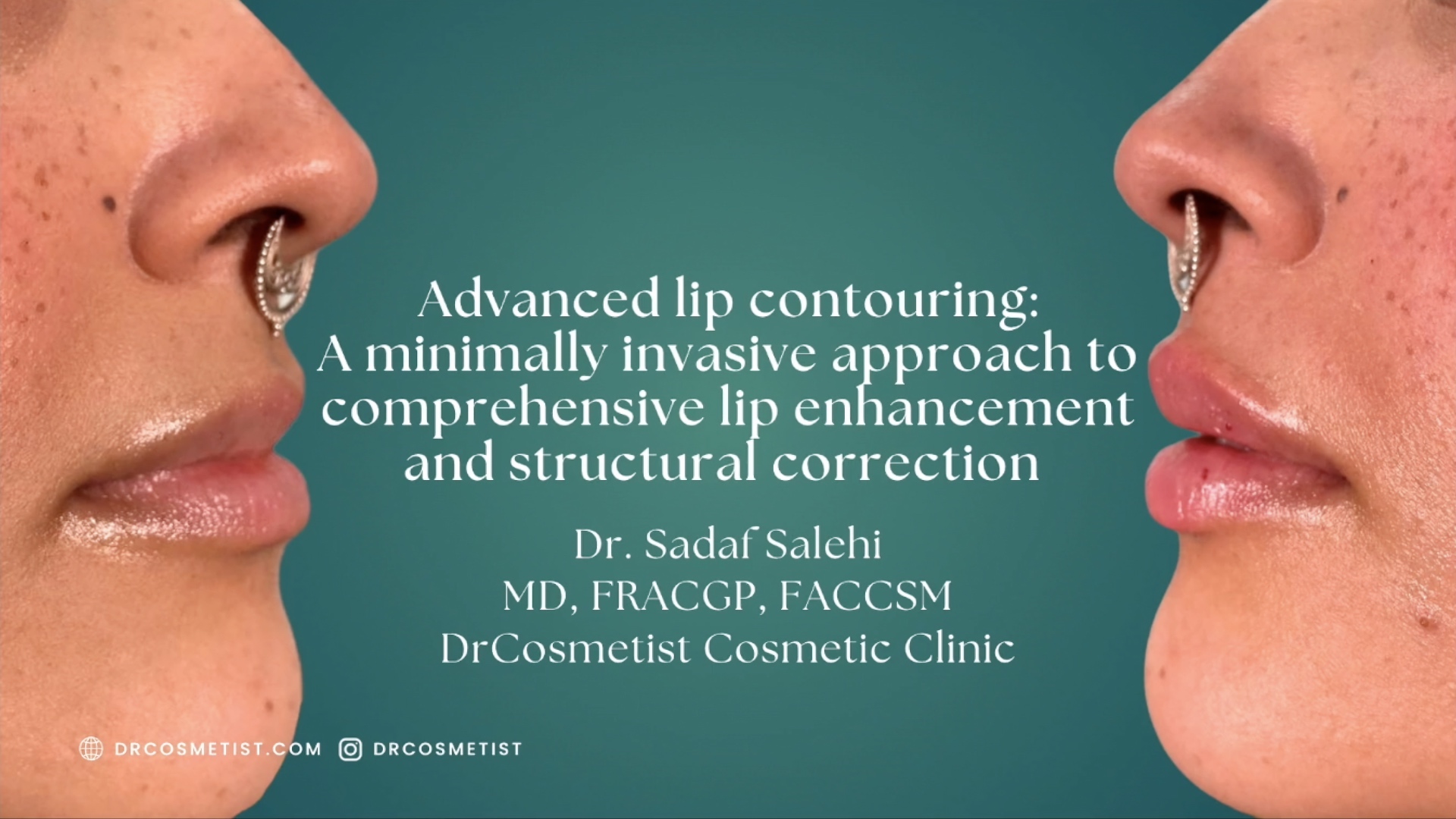 Advanced Lip Contouring